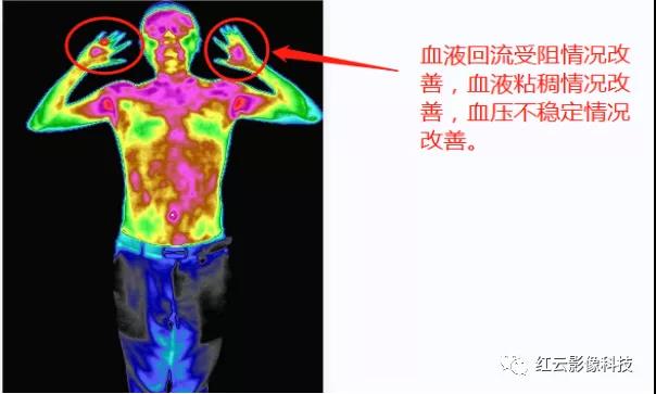 图4 调理一个月后头面部和手部图.jpg